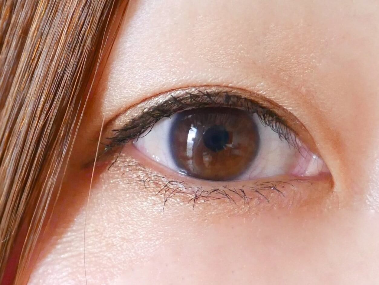 埋没法で奥二重になった場合の修正方法