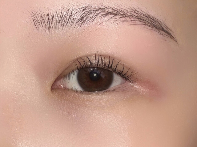 まぶたの状態から判断する切開による他院修正の可否とリスク