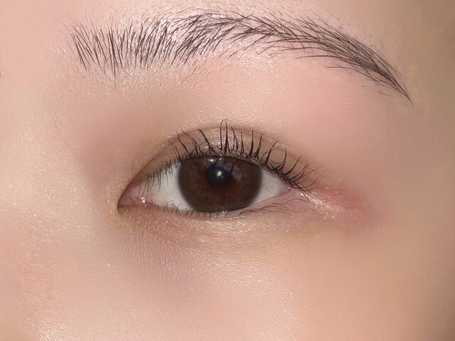 なぜ全切開後の二重修正をしたいと感じるのか？